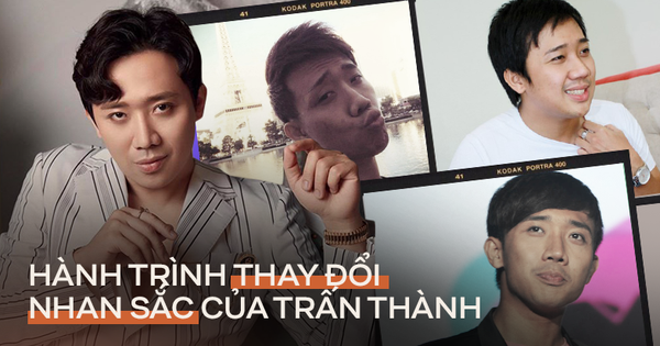 Hành trình 14 năm Trấn Thành lột xác ngoại hình ngoạn mục, thừa nhận dao kéo vì 