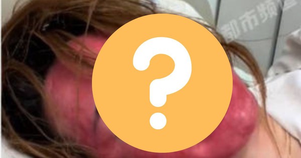 Khuôn mặt của người phụ nữ 22 năm không tẩy trang gây sốc