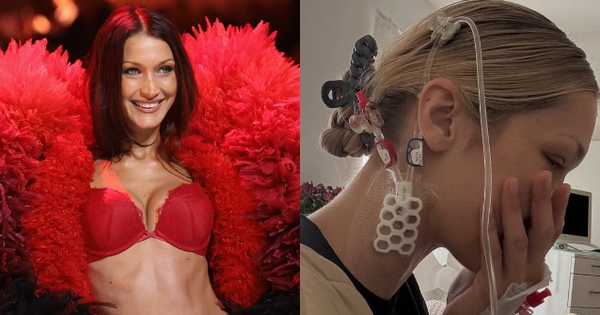 Em gái siêu mẫu của Gigi Hadid vật vã đau đớn vì căn bệnh nguy hiểm liên quan đến não