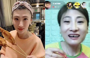 Ăn tới vỡ răng khi đang mukbang, nữ streamer bị khán giả ném đá nặng nề, CĐM dự đoán 