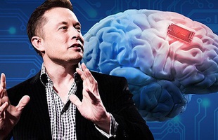 Elon Musk tự tin về công nghệ 'cấy chip não'