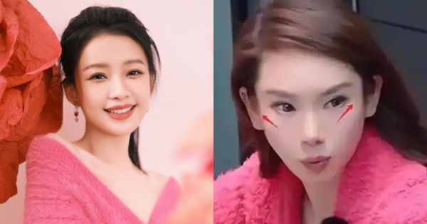 So sánh Tôn Di tuổi 32 và Thích Vy tuổi 41 liền nhận ra ngay sự "quá đà" trong việc can thiệp thẩm mỹ