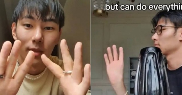 Không ngón cái, chàng trai vẫn làm đủ việc khiến ai cũng ngả mũ