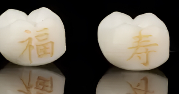Độc lạ trào lưu xăm răng của giới trẻ Trung Quốc