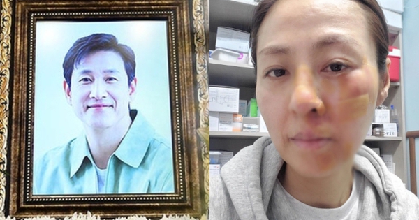 Bi kịch dồn dập: Tài tử Lee Sun Kyun qua đời 3 tháng thì cha mất vì bệnh, giờ đến lượt vợ gặp tai nạn