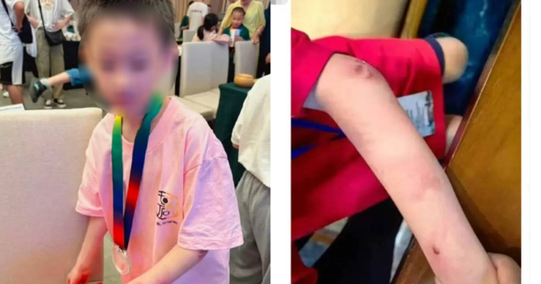 Vụ việc gây rúng động: Thần đồng cờ vây 9 tuổi nghi nhảy lầu tự tử, cộng đồng mạng bàng hoàng