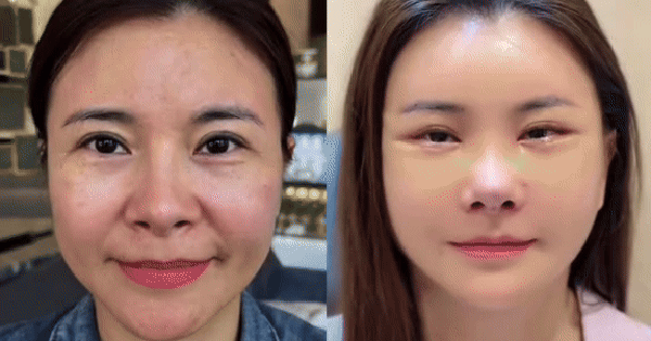 Diễn viên Kim Oanh lên tiếng sau khi gây tranh cãi vì phẫu thuật thẩm mỹ cả gương mặt