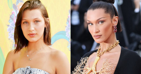 Bella Hadid có gương mặt tỷ lệ hoàn hảo hiếm hoi đến mức bác sĩ thẩm mỹ phải công nhận nhưng hóa ra từng làm 2 thủ thuật này?