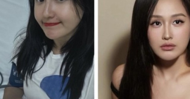 Hoa hậu Mai Phương Thúy khó thở khi đang ăn lẩu, phải nhập viện cấp cứu