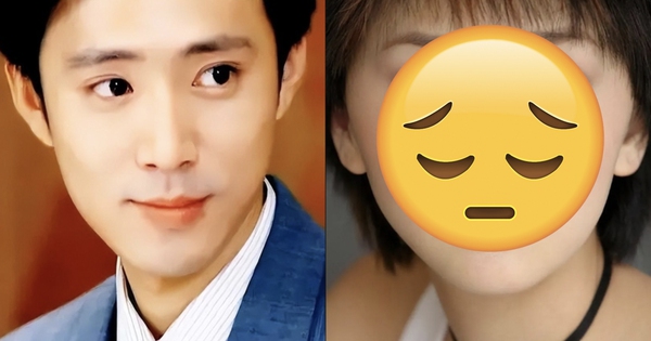 Nữ diễn viên gặp tai nạn biến dạng gương mặt, bạn trai ra 1 quyết định khiến cả showbiz sững sờ