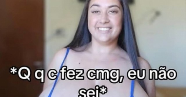 Cô gái vui mừng khi được giải thoát khỏi 'bộ ngực khủng' 12 kg