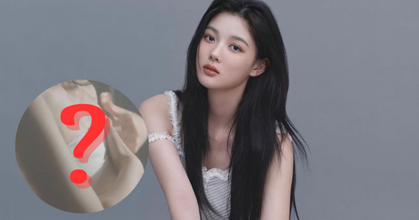 Bức ảnh xấu hổ nhất cuộc đời Kim Yoo Jung