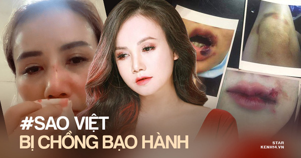 Trước “cô Xuyến” Hoàng Yến, loạt sao Việt từng bị chồng bạo hành dã man: Dương Yến Ngọc chịu đánh 2-3 lần⁄ tuần, 1 Hoa hậu còn muốn tự tử