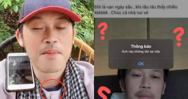 Netizen soi loạt chi tiết nghi vấn NS Hoài Linh không có vết sẹo mổ u tuyến giáp, xóa cả ảnh vì sơ hở, thực hư ra sao?