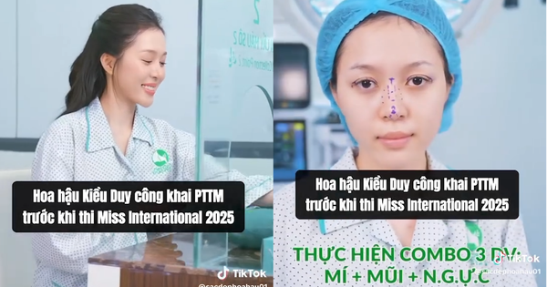 Thêm Hoa hậu 2k3 nhà Sen Vàng công khai “dao kéo” trước thềm thi Quốc tế