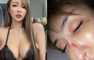 Chỉ đi tắm nhưng vẫn gặp tai nạn nghiêm trọng, nàng hot girl khiến CĐM sốc nặng: 