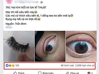 Nối mi giả mất luôn hàng mi thật, cô gái chỉ còn kêu trời 