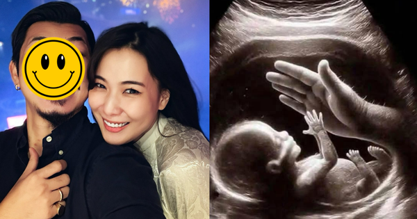 Nam diễn viên Việt và vợ Hoa khôi thông báo có con sau gần 2 năm kết hôn