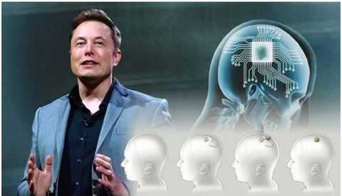 Elon Musk dự đoán tiến trình cấy chip não người sau 20 năm tới