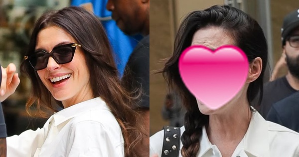 Nhan sắc giả dối của Anne Hathaway