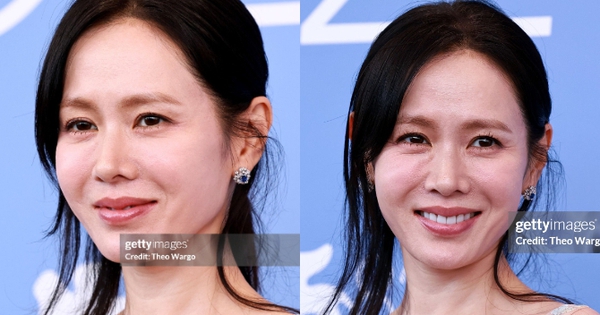 "Quốc bảo nhan sắc" Son Ye Jin làm sao thế này?