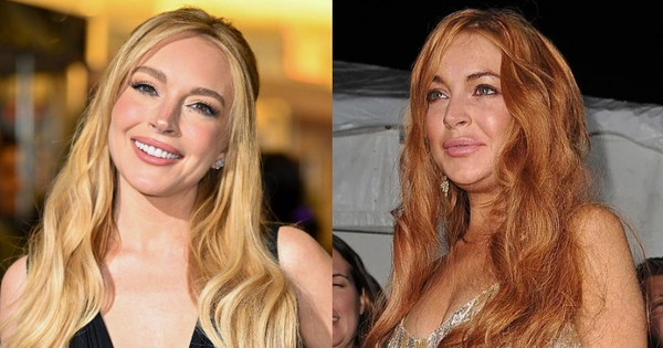 Lindsay Lohan đã "dao kéo" những gì để có diện mạo lột xác như hiện tại?